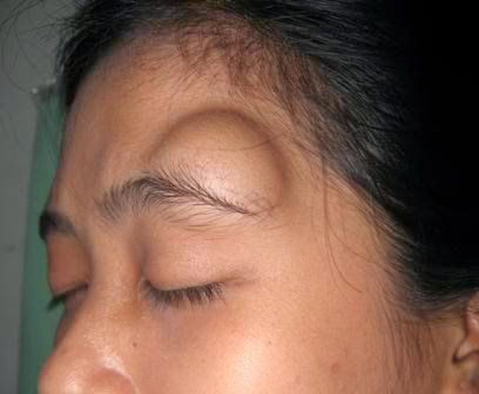 How to  diagnose?