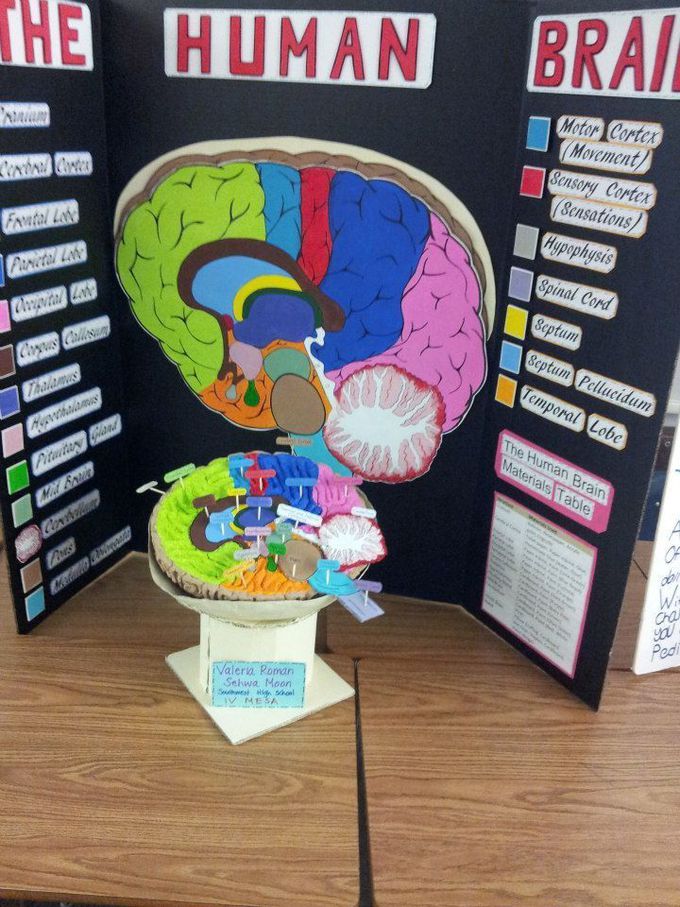 Brain... Med students exhibition