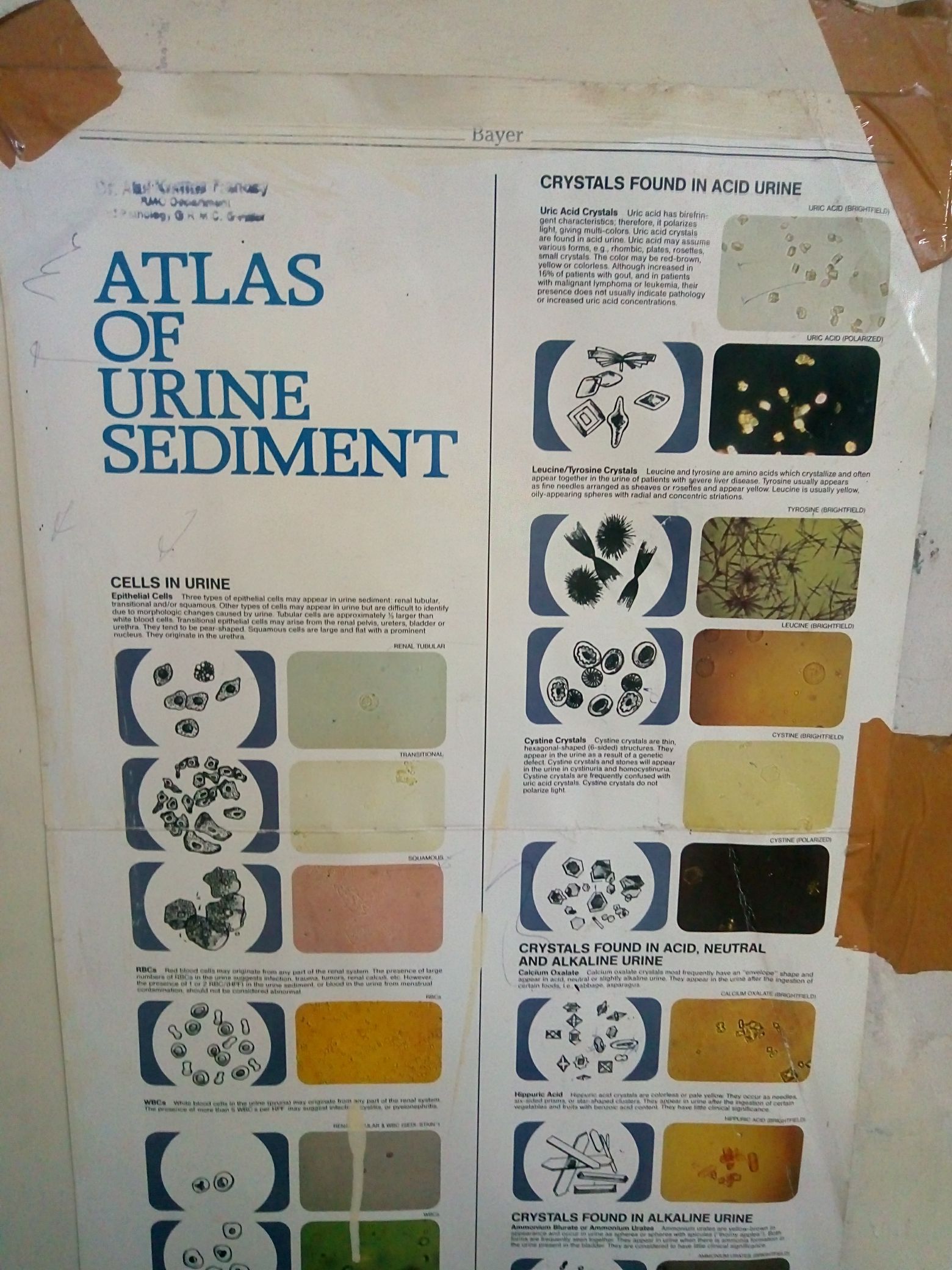 Cells In Urine Sediment Chart Urine Sediments Posters And Binder Cards