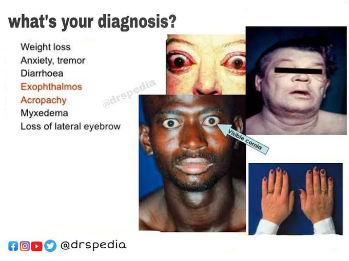 What's your diagnosis?