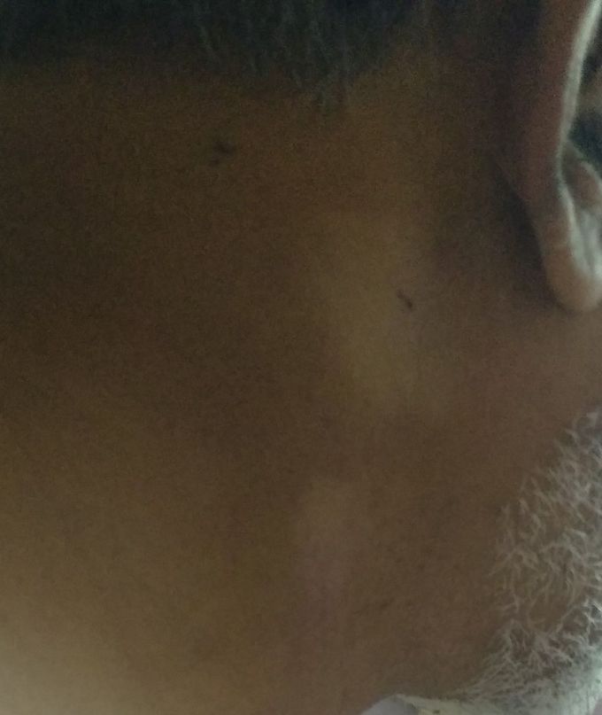 What is its diagnosis plzz reply yr views on it