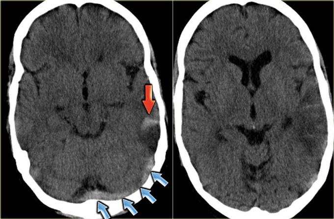 What is your diagnosis?