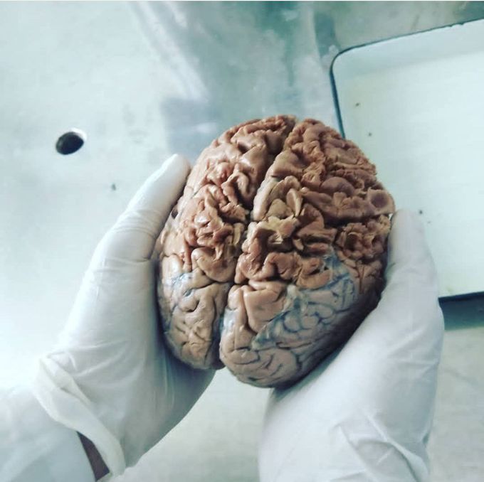 HUMAN BRAIN