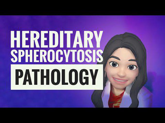 Descriptive pathology of Hereditary Spherocytosis