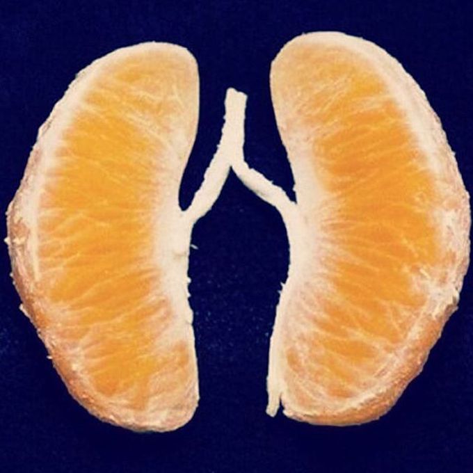 Like & answer: Which organ is this? 