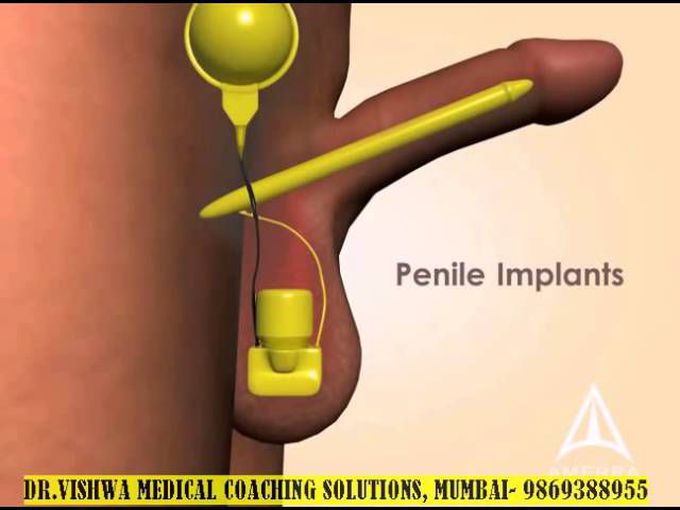 Erectile Dysfunction Education DR VISHWA MEDICAL COACHING, MUMBAI 9869388955