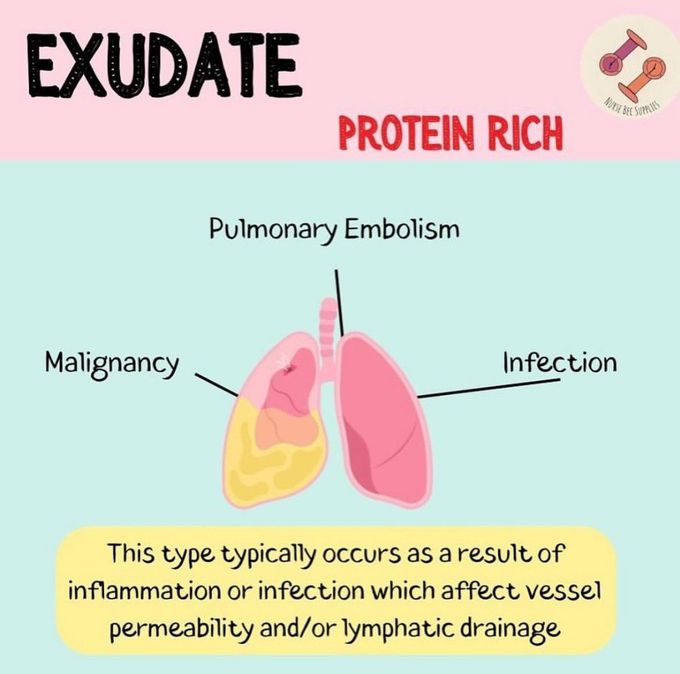 Exudate