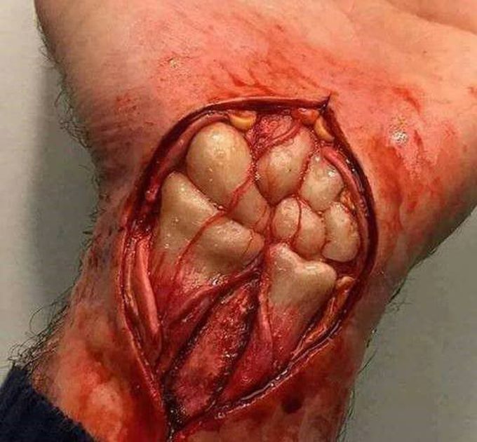 Bones of Wrist