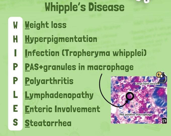 Whipple's Disease