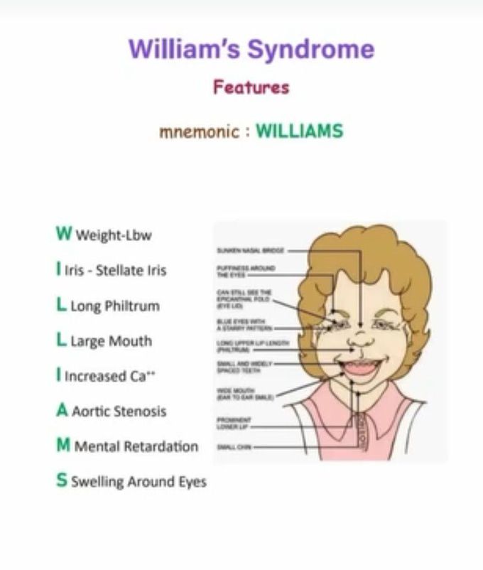 William Syndrome