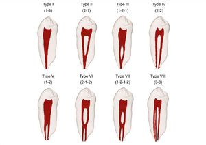 Vertucci’s classification for root canal morphology - MEDizzy