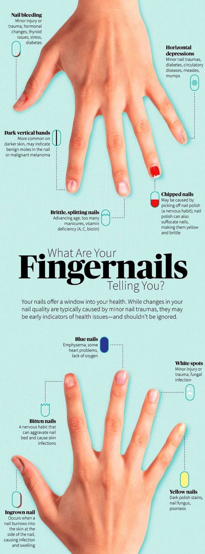 what are your fingernails telling you - MEDizzy