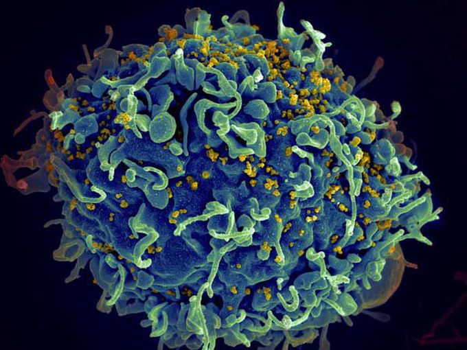 New HIV therapy reduces virus, boosts immunity in drug-resistant patients