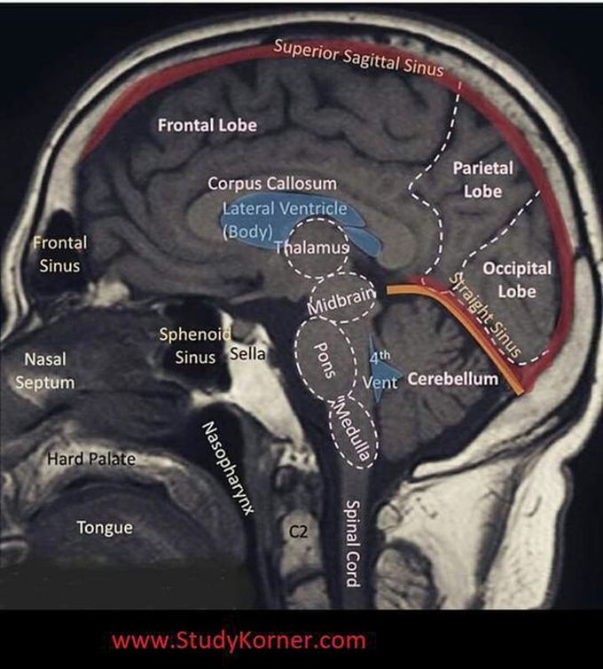 Well Labeled MRI of the Brain 🧠