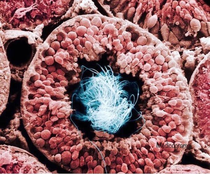 Cross section from a seminiferous tubule of a testicle