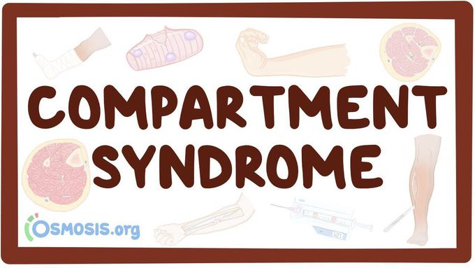 Compartment syndrome - causes, symptoms, diagnosis, treatment, pathology