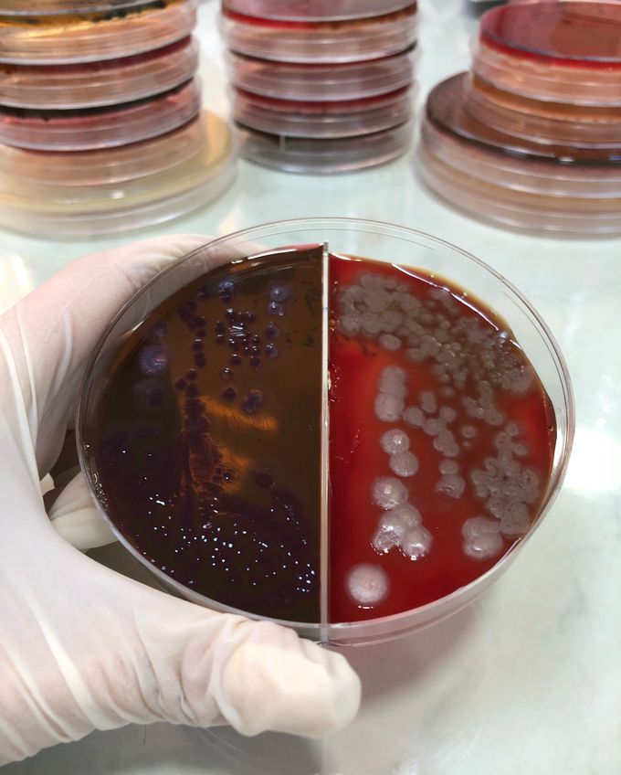 Pseudomonas aeruginosa on blood and EMB agars