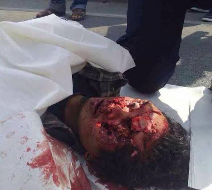 Bike accident