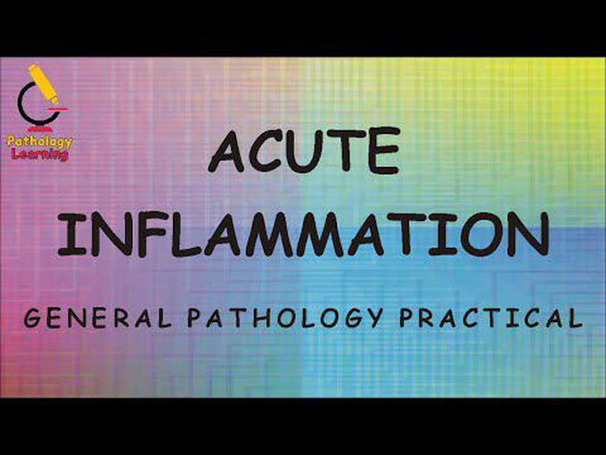 Acute Inflammation