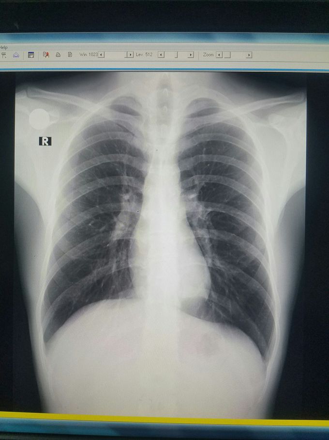 Dx???