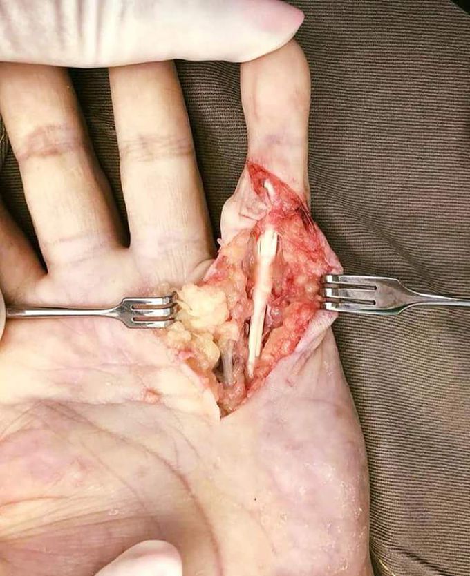 Identify bone ????