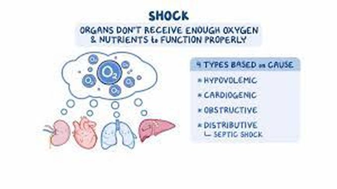 Septic shock