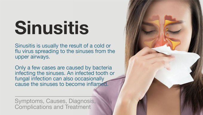 Sinuses Risk Factors