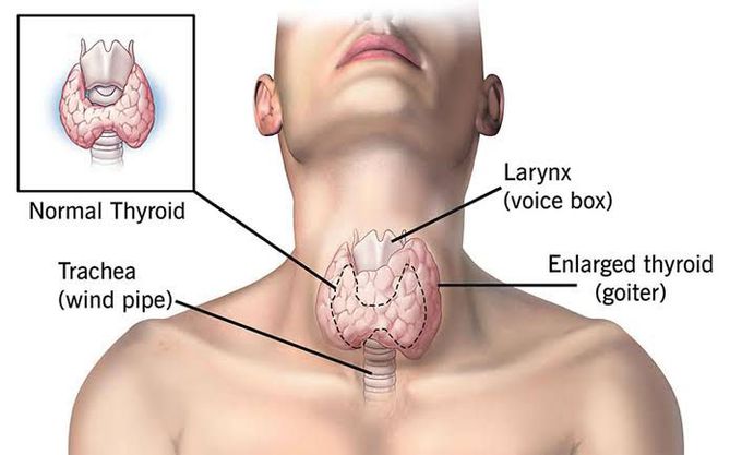 causes of thyrotoxicosis