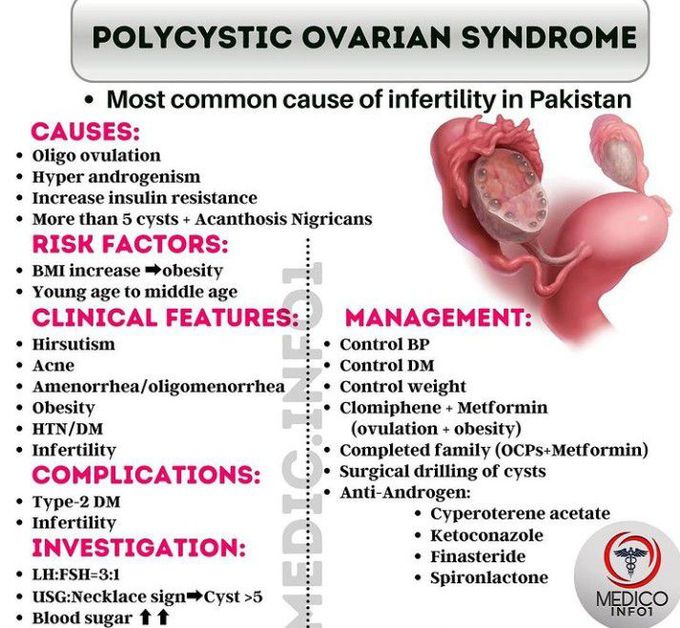 Poly cystic ovarian syndrome