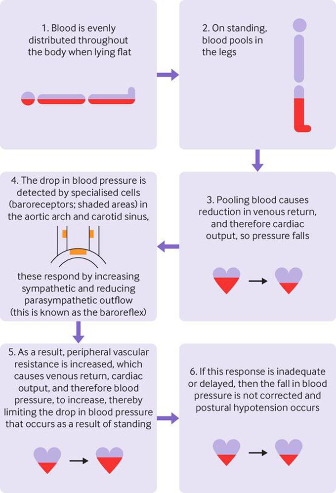 Lying & Standing Blood Pressure, Postural Hypotension