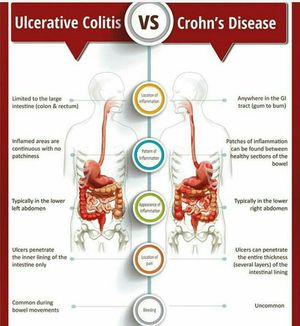 IBD - MEDizzy