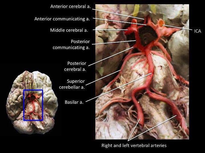 circle of willis brain