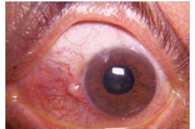 What is your diagnosis?