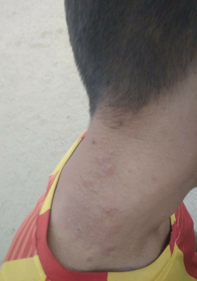 What is your diagnosis.. Comments fast..!!