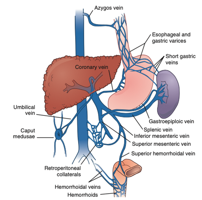 Symptoms of portal hypertension