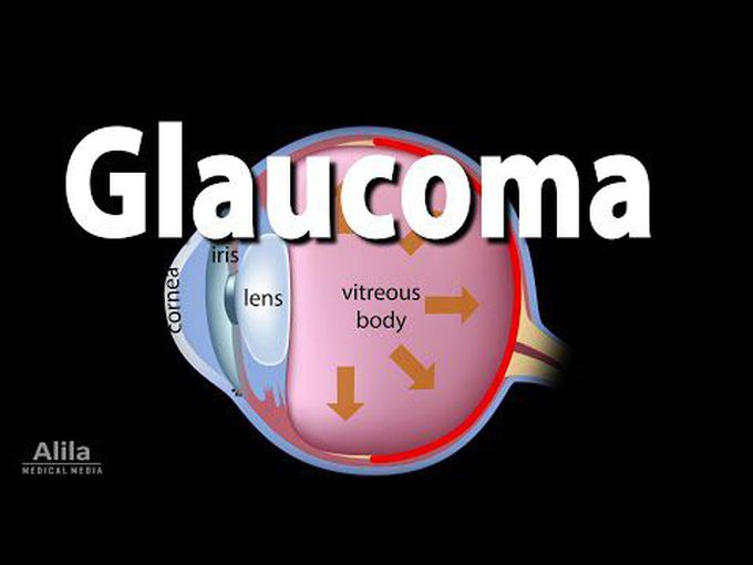 Special senses:
Glaucoma
