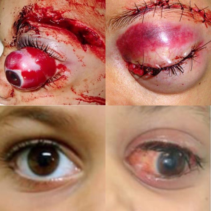 DISCREATION⚠️❌🔞❗️profesional educational contect A RARE CASE REPORT!!!