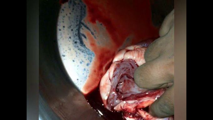 cardiology/Heart/COW HEART/internal structures/ fresh dissection/Anatomy