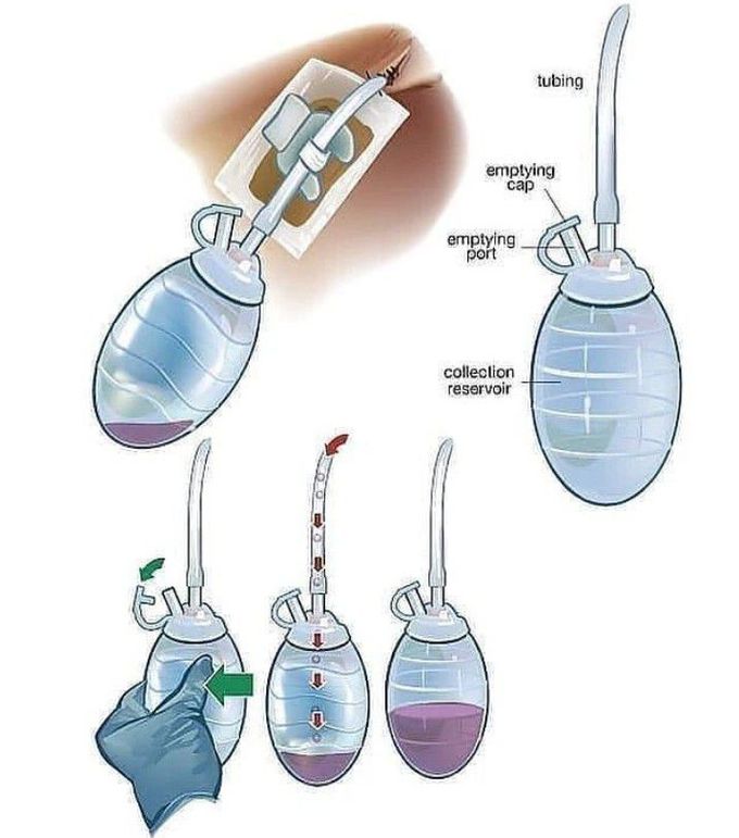 Structure of surgical drain