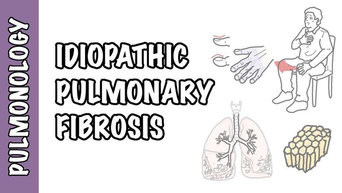 Idiopathic Pulmonary Fibrosis
