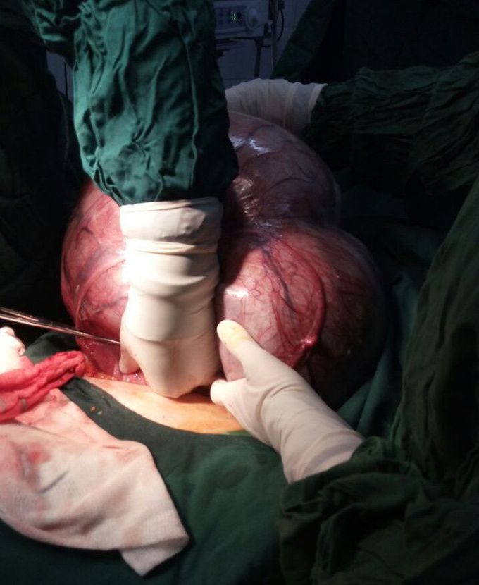 A wonderful case in the operating room.