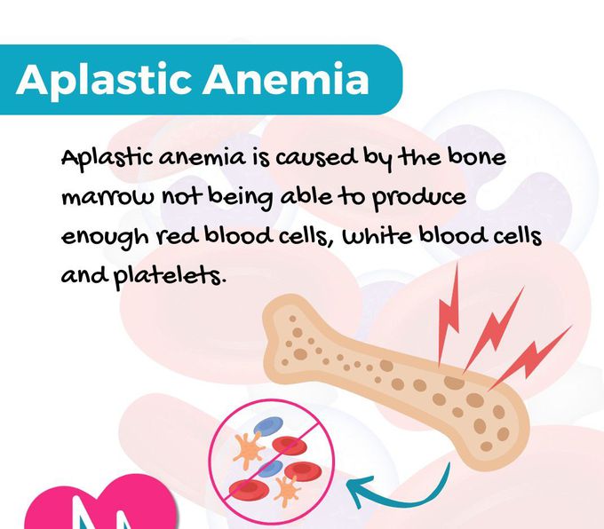 Aplastic Anemia