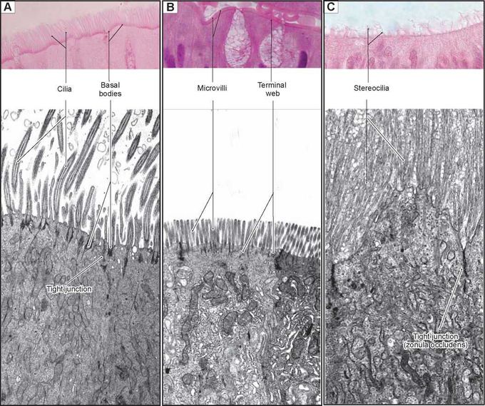 Stereocilia