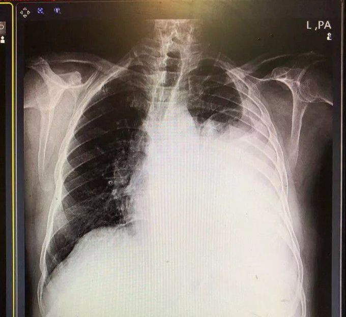 trauma surgery