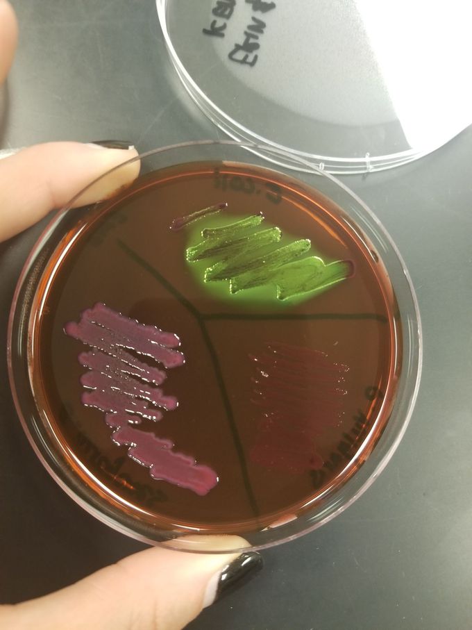 Streak plate🧫🧪