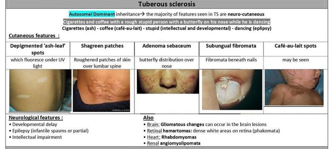 Tuberous Sclerosis