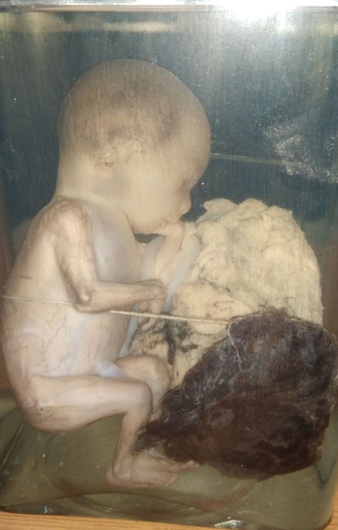 Baby....heavenly..dissolved in solutions