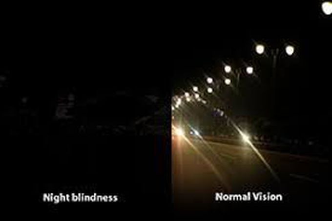 Night blindness