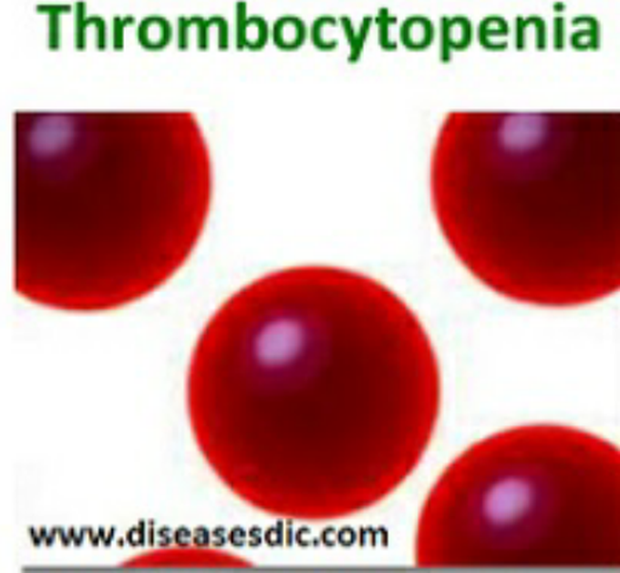 Thrombocytopenia