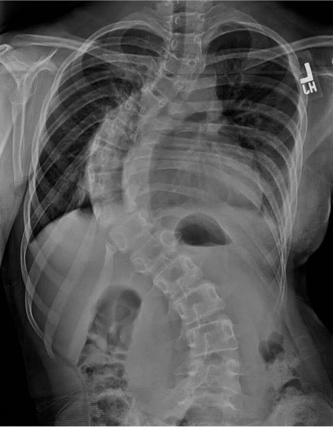 Identify the Pathology